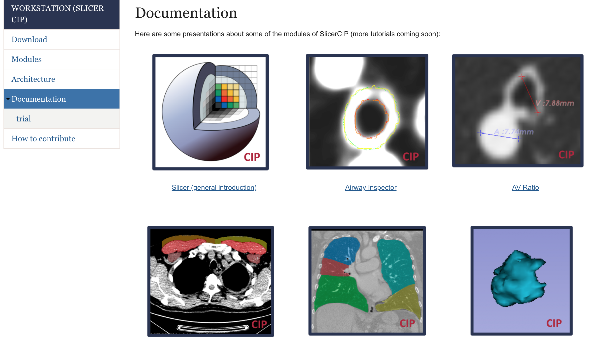 Lung segmentation + DFV